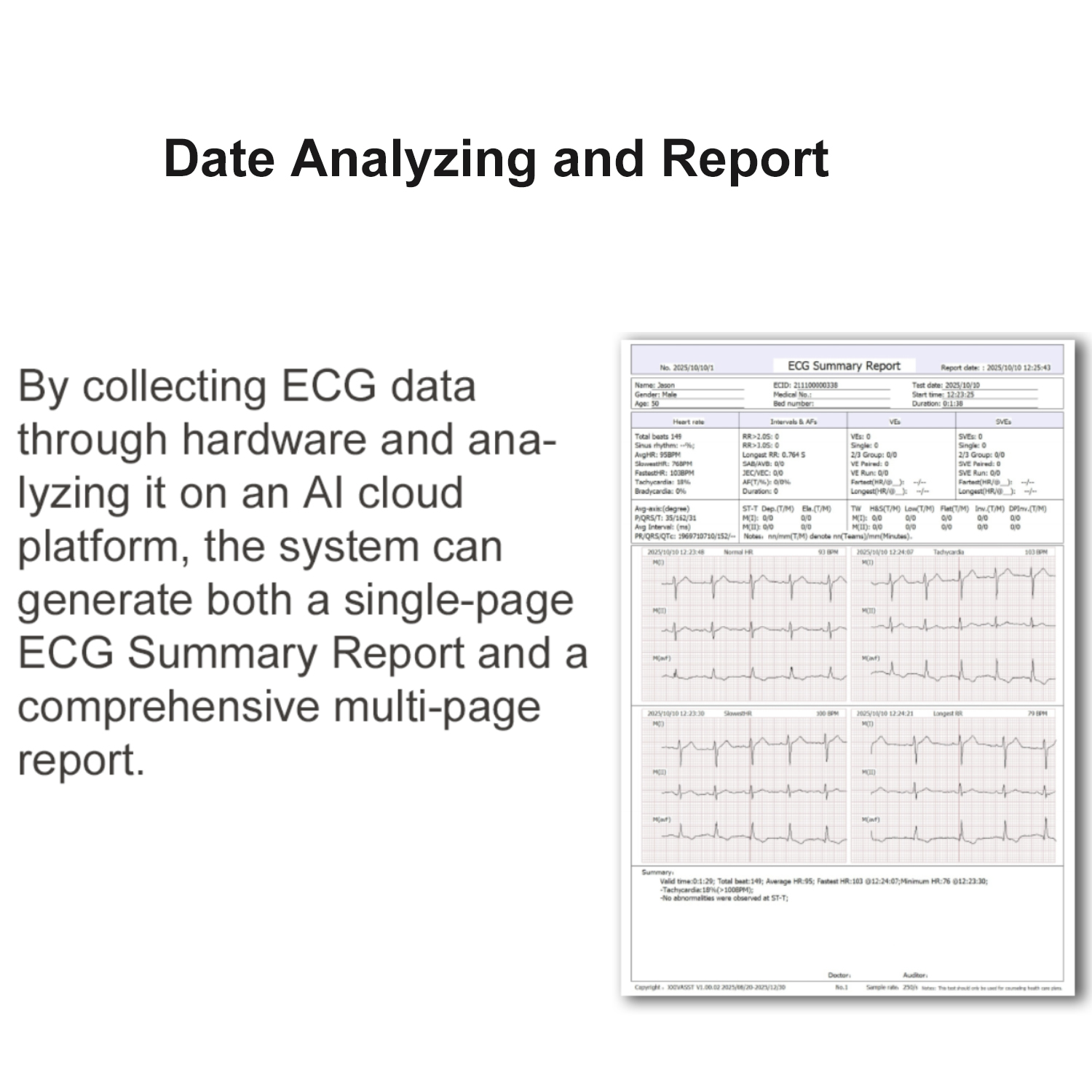 Dynamic ECG Recorder - Image 7